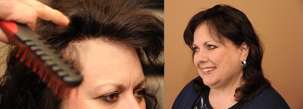women's natural Hair replacement - Hairstyle